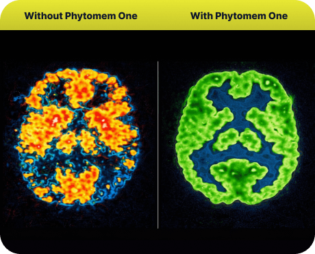 Phytomem One Benefits